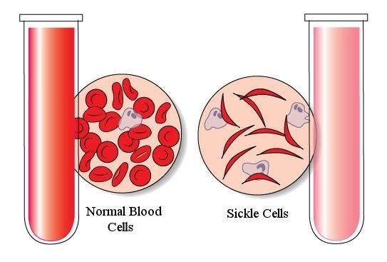 Intensive Care Unit (ICU)